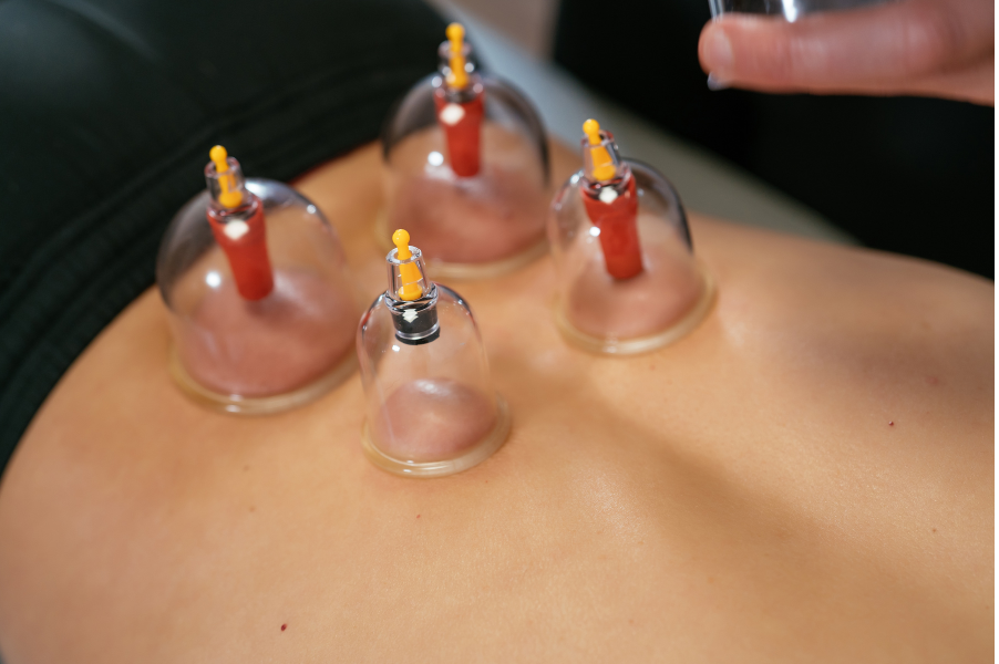 Cupping ventouse